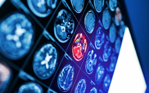 Life Science Meeting zu „Medical Imaging: Latest developments and trends“